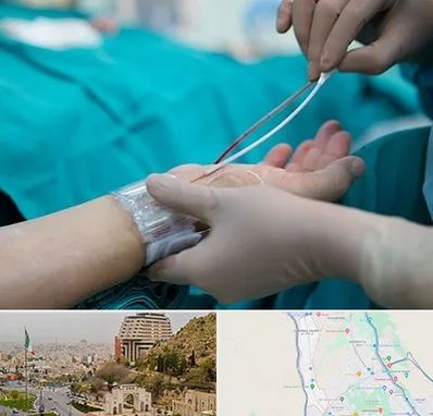 آنژیوگرافی در فرهنگ شهر شیراز