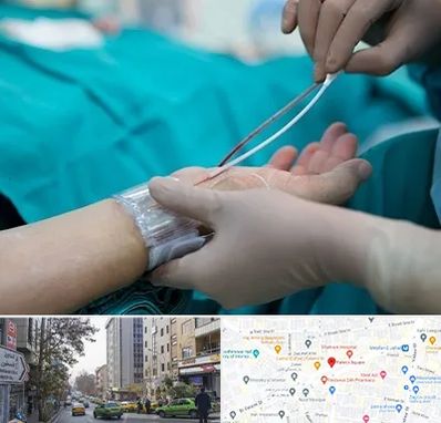 آنژیوگرافی در فاطمی