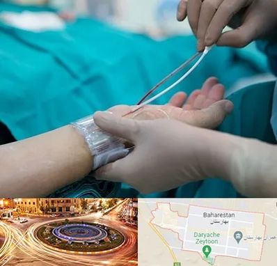 آنژیوگرافی در بهارستان