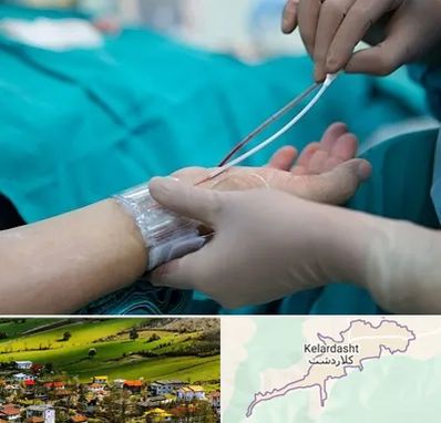 آنژیوگرافی در کلاردشت