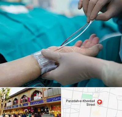 آنژیوگرافی در 15 خرداد