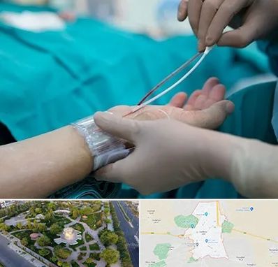 آنژیوگرافی در کاشمر