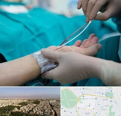 آنژیوگرافی در نازی آباد