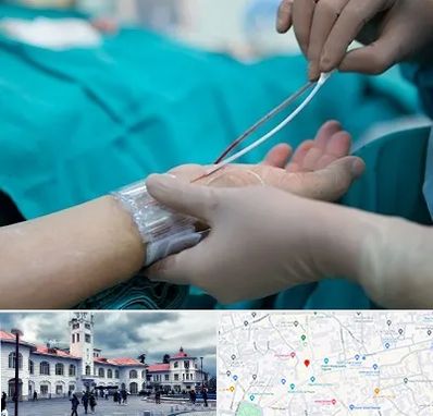 آنژیوگرافی در میدان شهرداری رشت