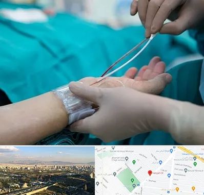 آنژیوگرافی در هنگام