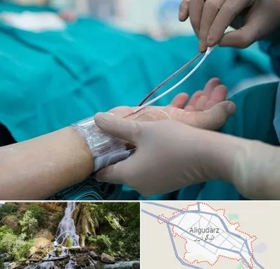 آنژیوگرافی در الیگودرز