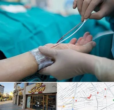 آنژیوگرافی در عطاران قم