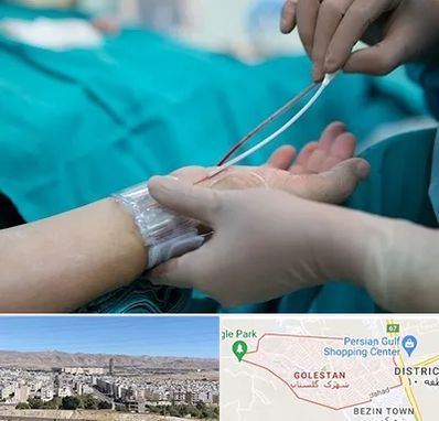 آنژیوگرافی در شهرک گلستان شیراز