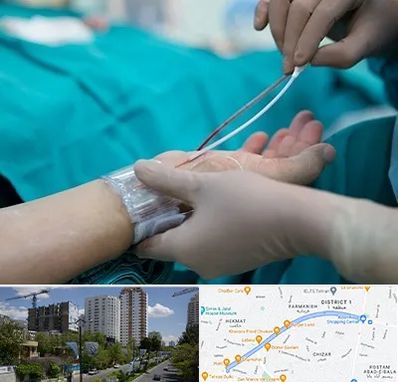 آنژیوگرافی در اندرزگو