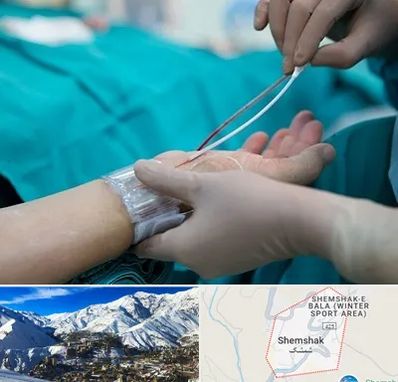 آنژیوگرافی در شمشک