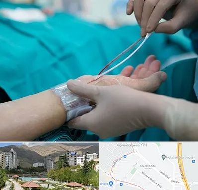 آنژیوگرافی در شهر زیبا