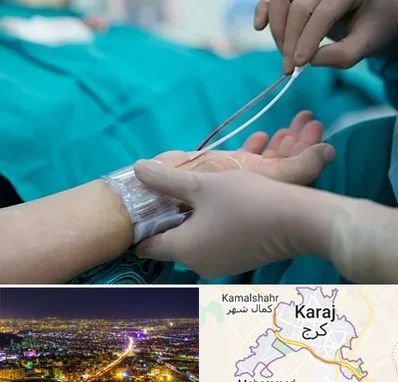 آنژیوگرافی در کرج