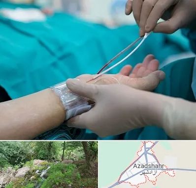 آنژیوگرافی در آزادشهر