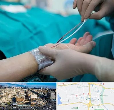 آنژیوگرافی در شهرک راه آهن