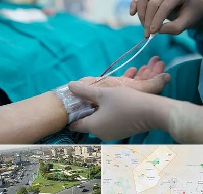 آنژیوگرافی در کمال شهر کرج