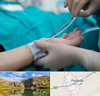 آنژیوگرافی در فیروزکوه