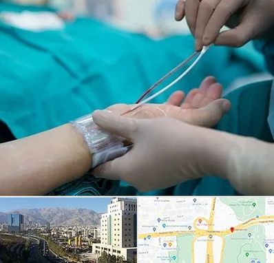 آنژیوگرافی در حقانی