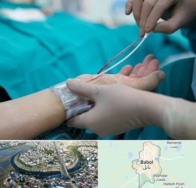 آنژیوگرافی در بابل