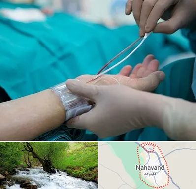 آنژیوگرافی در نهاوند