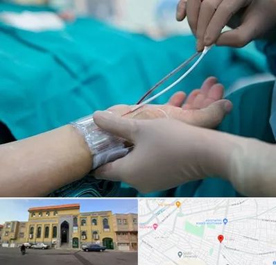 آنژیوگرافی در زنبیل آباد قم