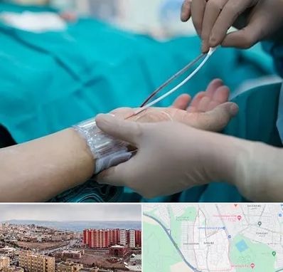 آنژیوگرافی در سهند تبریز