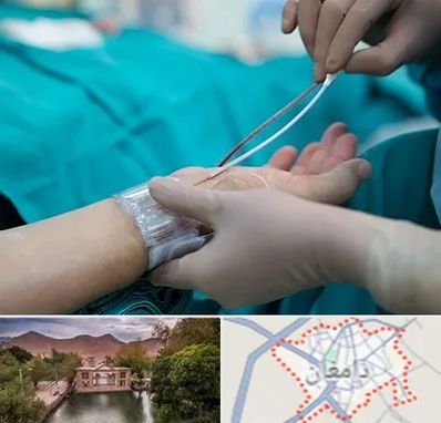 آنژیوگرافی در دامغان