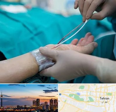 آنژیوگرافی در غرب تهران 