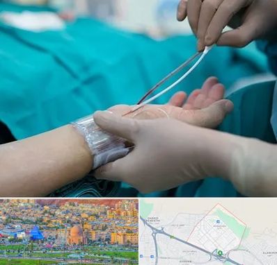 آنژیوگرافی در رشدیه تبریز