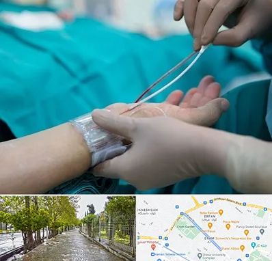 آنژیوگرافی در خیابان ارم شیراز