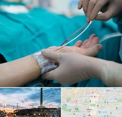 آنژیوگرافی در منطقه 2 تهران