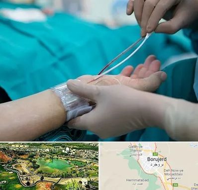 آنژیوگرافی در بروجرد