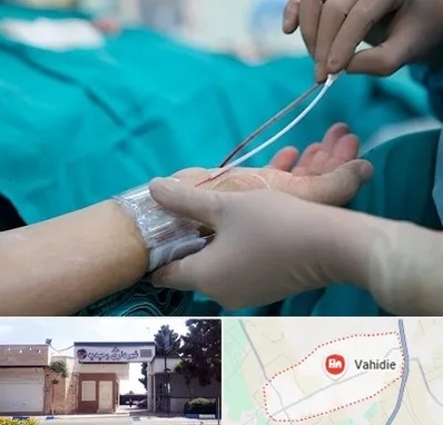 آنژیوگرافی در وحیدیه شهریار