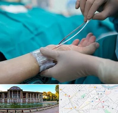 آنژیوگرافی در عفیف آباد شیراز