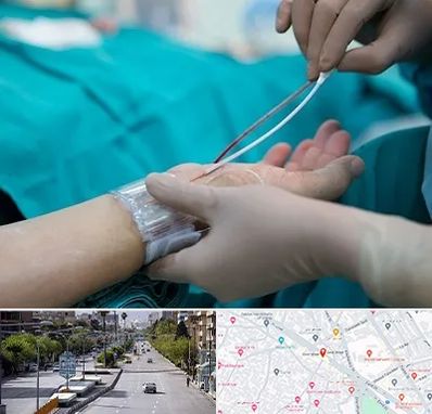 آنژیوگرافی در خیابان زند شیراز