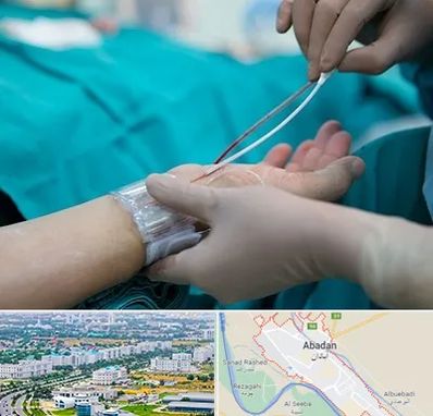 آنژیوگرافی در آبادان