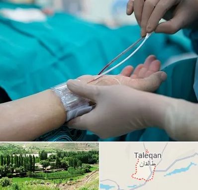 آنژیوگرافی در طالقان