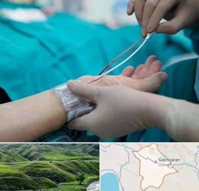 آنژیوگرافی در گچساران