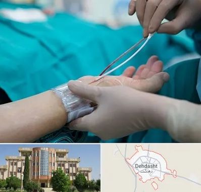 آنژیوگرافی در دهدشت