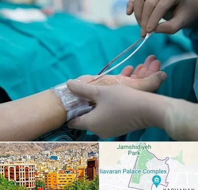 آنژیوگرافی در نیاوران 