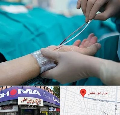 آنژیوگرافی در امین حضور