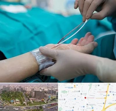 آنژیوگرافی در آیت الله کاشانی