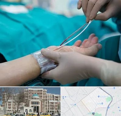 آنژیوگرافی در طلاب مشهد