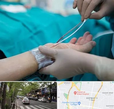 آنژیوگرافی در ظفر 