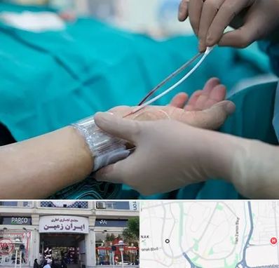 آنژیوگرافی در ایران زمین