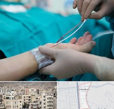 آنژیوگرافی در اسکندری