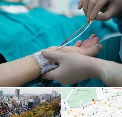 آنژیوگرافی در بلوار کشاورز