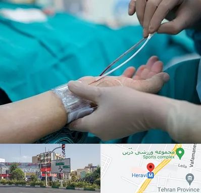 آنژیوگرافی در هروی 