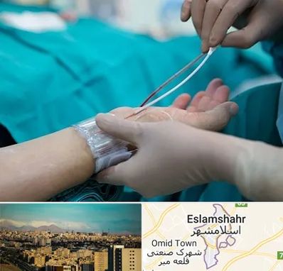 آنژیوگرافی در اسلامشهر