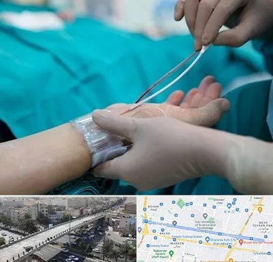 آنژیوگرافی در فرجام