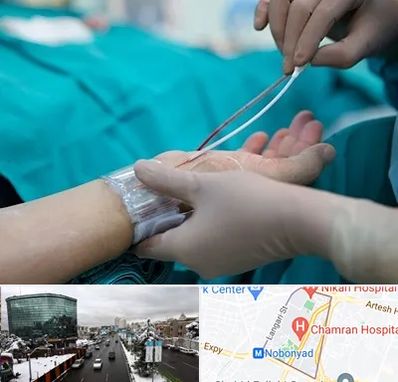 آنژیوگرافی در اقدسیه 